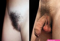 pubis nude