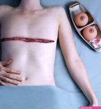 Breasts Yoav Katz