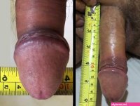 File:Dimensiones pene adulto.jpg