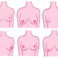 Under 20 Breast Cancer Foundation NZ