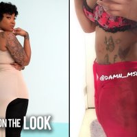 Injecting My 59 Booty Was A BIG Mistake