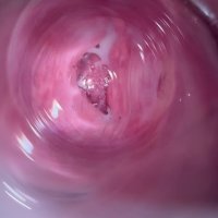 Camera deep inside teen creamy pussy