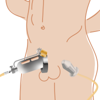 Watersports Kink Recylcer System with an anal plug chastity device...