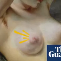 Like a lightning flash: what is a nipple orgasm?