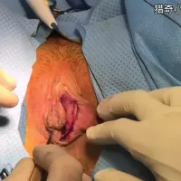 Female circumcision