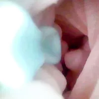 Endoscope Camera In Vagina Porn Videos