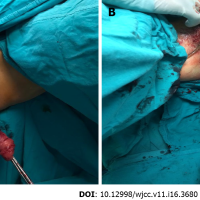 Current diagnostic tools and treatment modalities for rectal prolapse