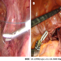Current diagnostic tools and treatment modalities for rectal prolapse
