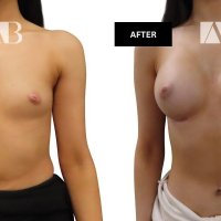 Real or Fake Boobs