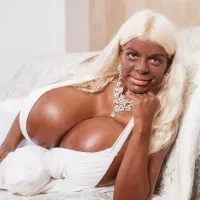 Glamour model with biggest boobs in Europe shocks fans with crispy brown look after extreme tanning injections