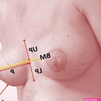 Metrics of the Aesthetically Perfect Breast