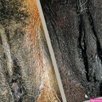 Vaginal and Anal Bleaching Before and After Pictures in Orlando FL