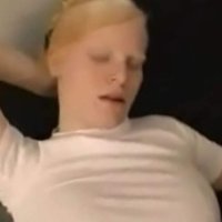 Albino girl and gets facial