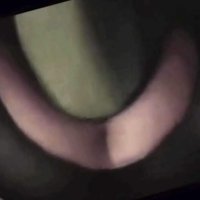 Black Widow Hulk deleted scenes