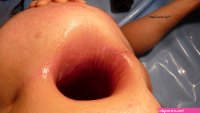 biggest anal gape