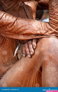 1139 Saggy Skin Stock Photos