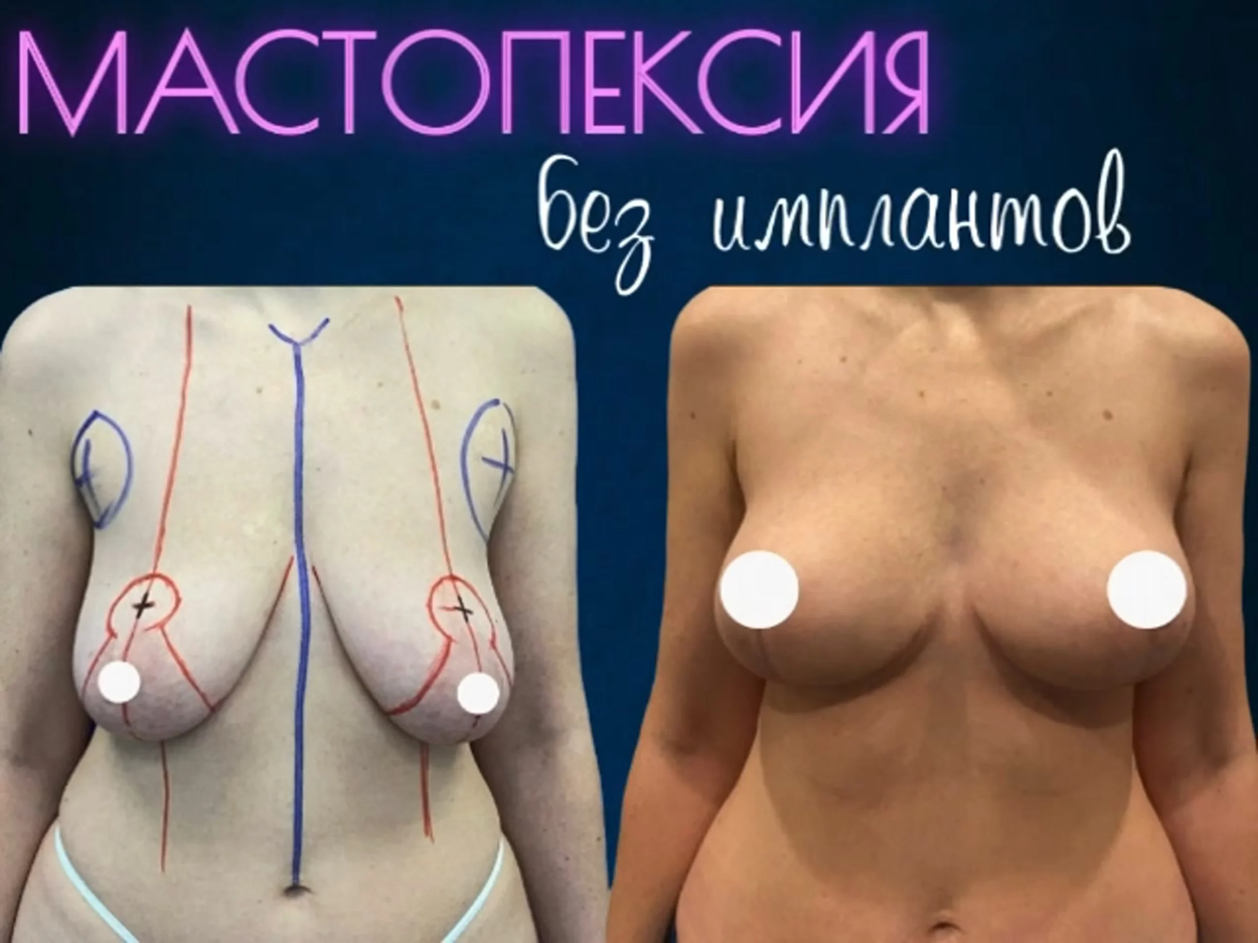 Snastasiia vlasova onlyfans naked
