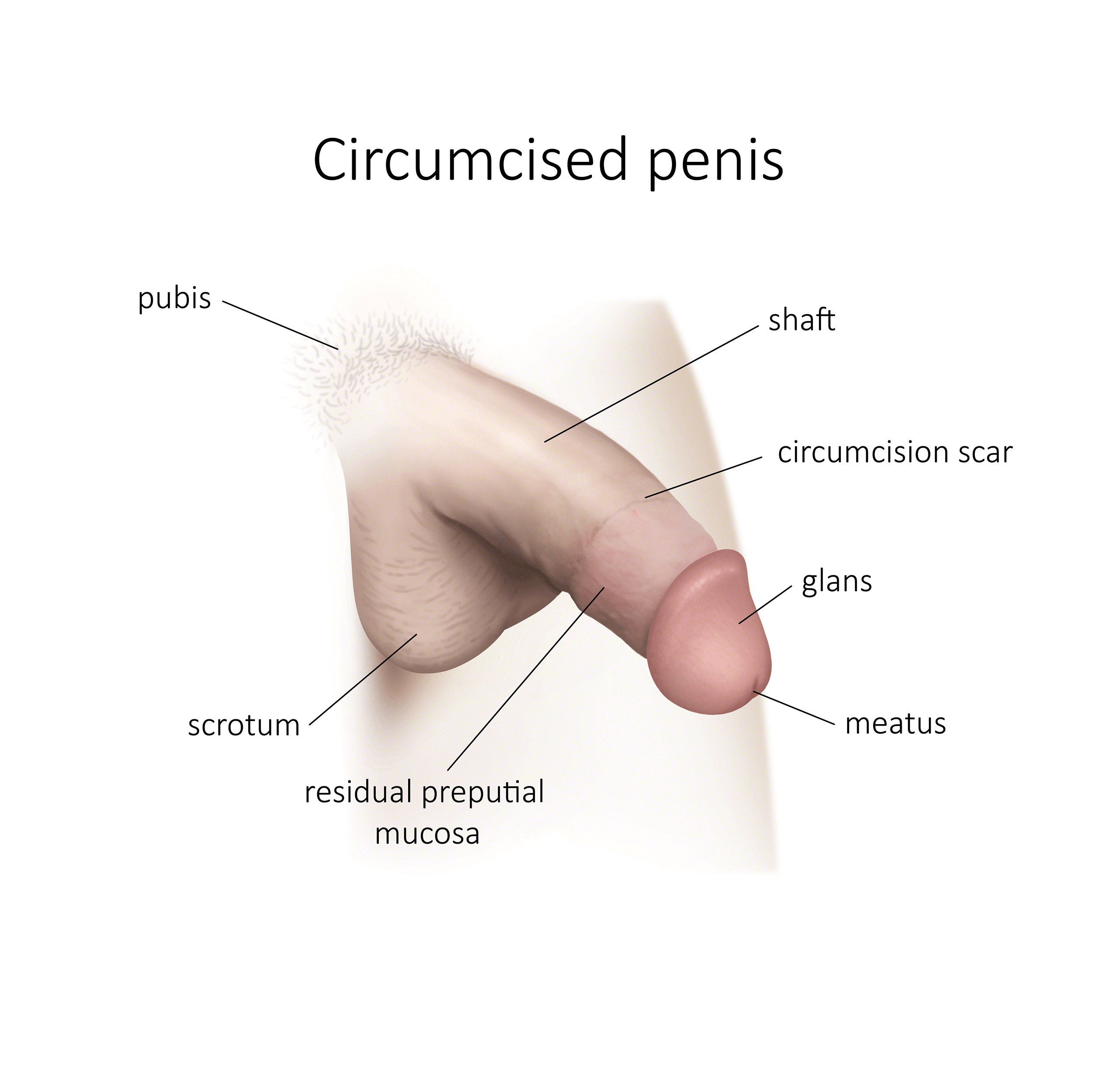 Tight circumcision surgery porn