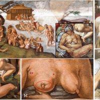 Experts suggest Michelangelo depicted breast cancer in the Sistine Chapel fresco