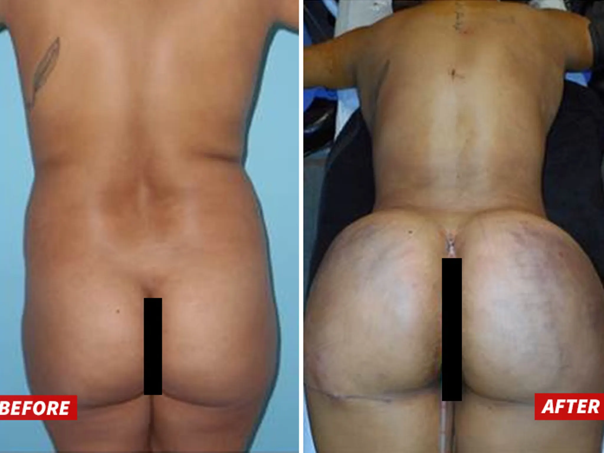 Before and after mom nude pics