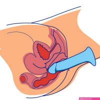 Anal Dildos: Everything You Need To Know